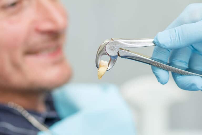 Unexpected tooth extraction emergency